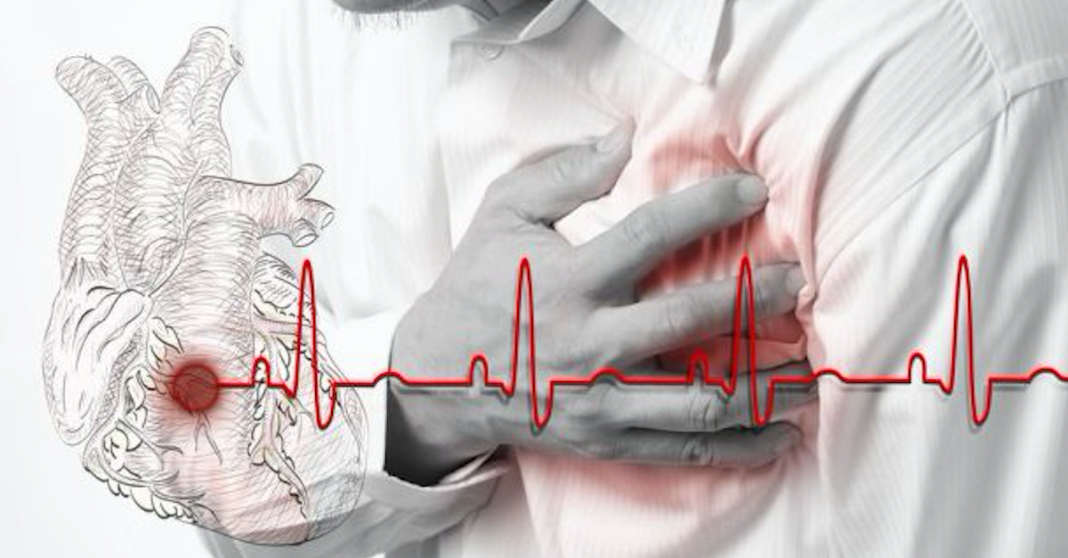 3 cách đơn giản để kiểm soát tốt các lệnh đang mở